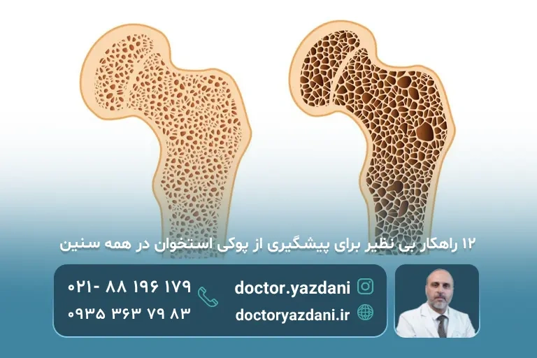 عکس پوک شدن استخوان 