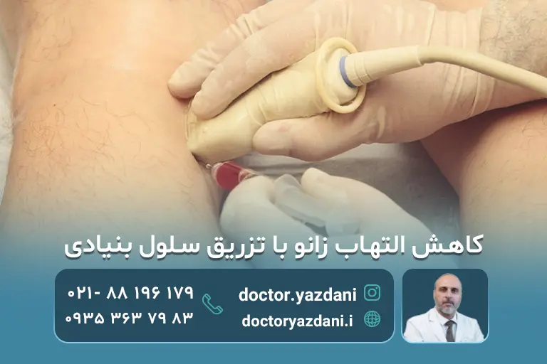 تزریق سلول بنیادی باعث کاهش التهاب زانو می‌شود؟