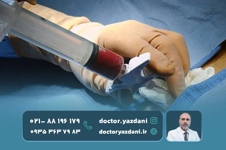 استخراج سلول بنیادی از بدن بیمار