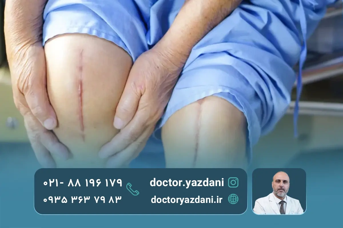 انحراف زانو چگونه درمان می‌شود؟