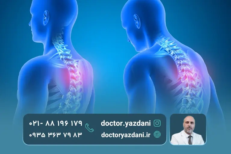 انواع اختلالات پوسچر بدن