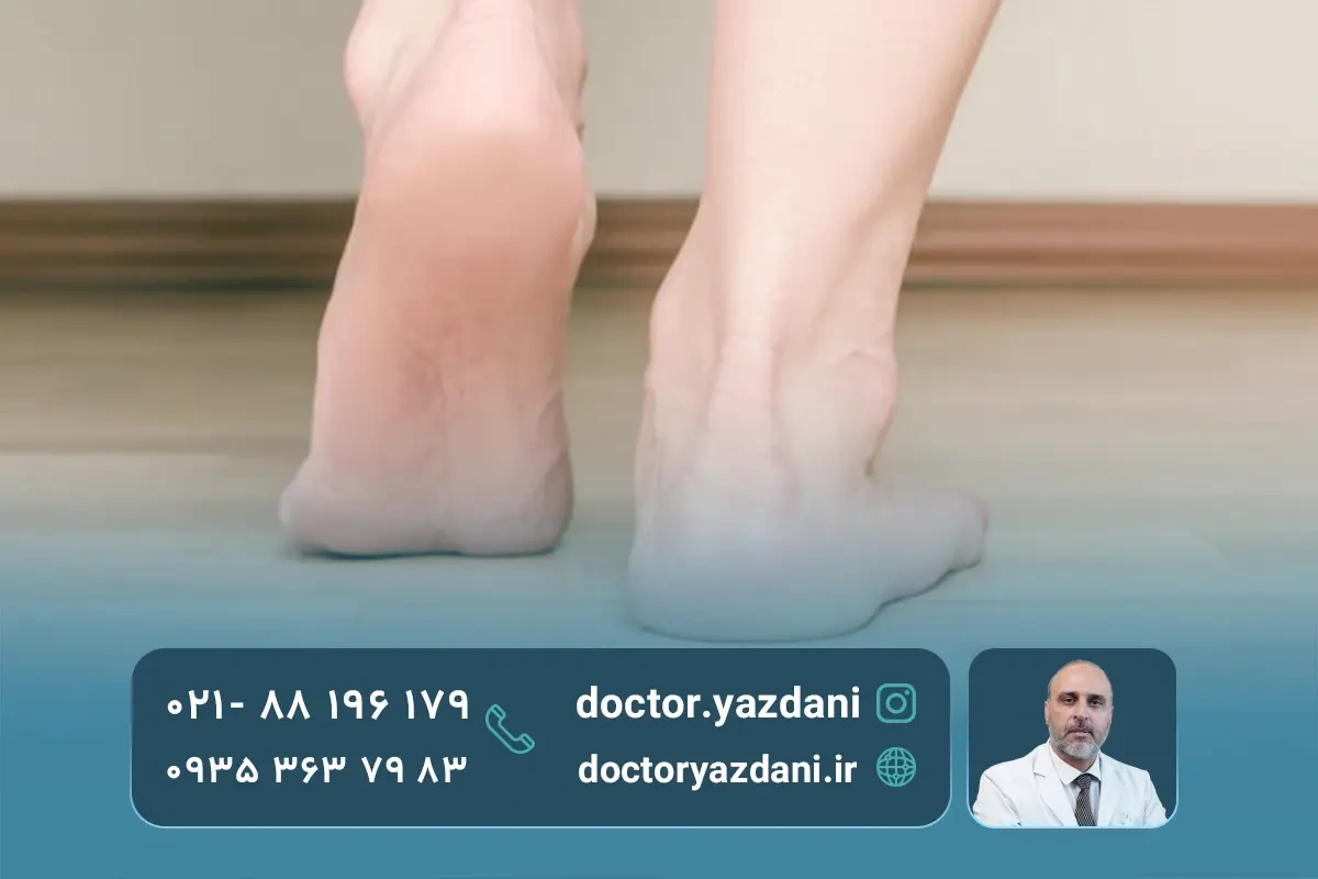 انواع صافی کف پا