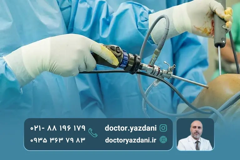 انواع عمل تعویض مفصل زانو