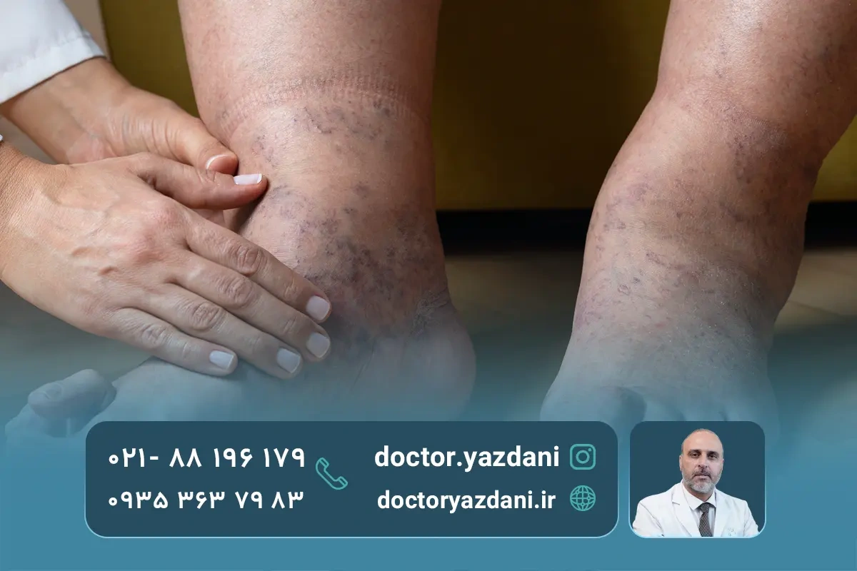 انواع مشکلات پا