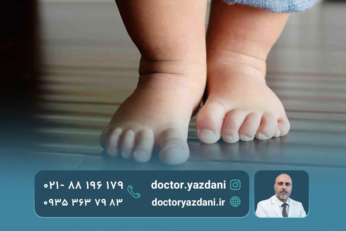 انواع کف پای صاف در کودکان