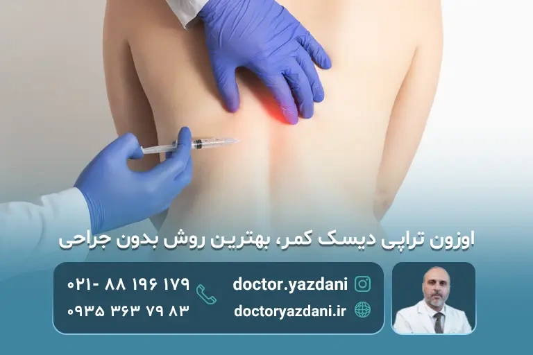 اوزون تراپی دیسک کمر توسط پزشک متخصص