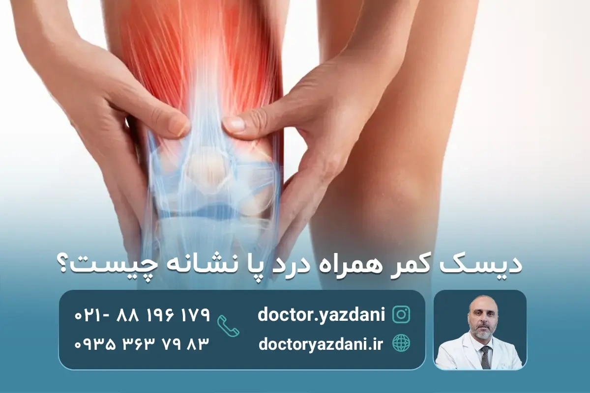 دیسک کمر در پاها چگونه بوجود می آید؟ علائم دیسک کمر در هر نقطه از پا