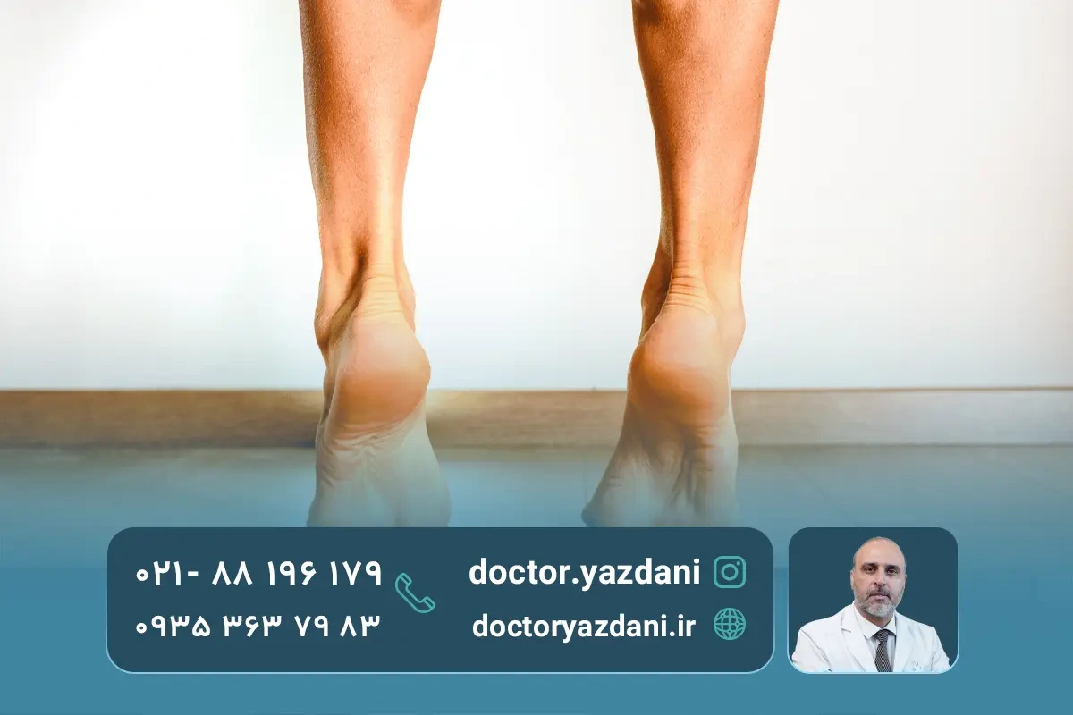 ایستادن روی پنجه‌ ها