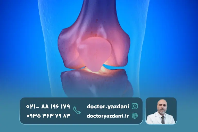 مزایای تزریق سلول بنیادی به زانو