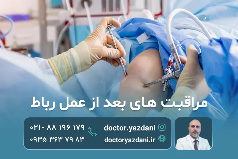 مراقبت از زانو بعد عمل رباط صلیبی