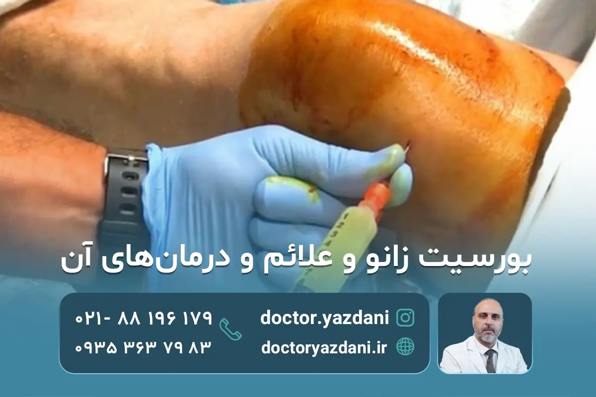 بورسیت زانو چیست؟علت علائم و روش های درمان