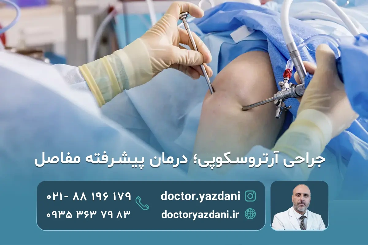 جراحی آرتروسکوپی چیست؟ (دوره نقاهت، مزایا و مراقبت‌های بعد از عمل)