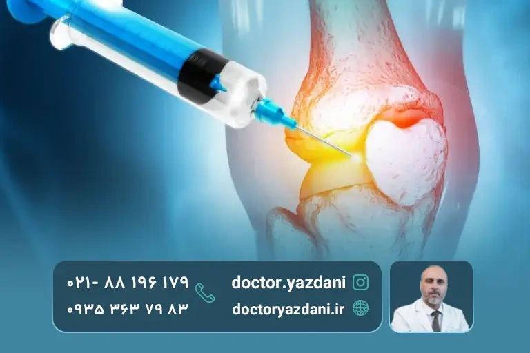 درمان بیماری مفصلی با تزریق سلول بنیادی