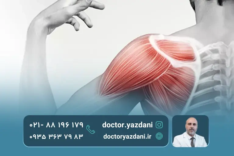 فیزیوتراپی شانه برای درمان درد