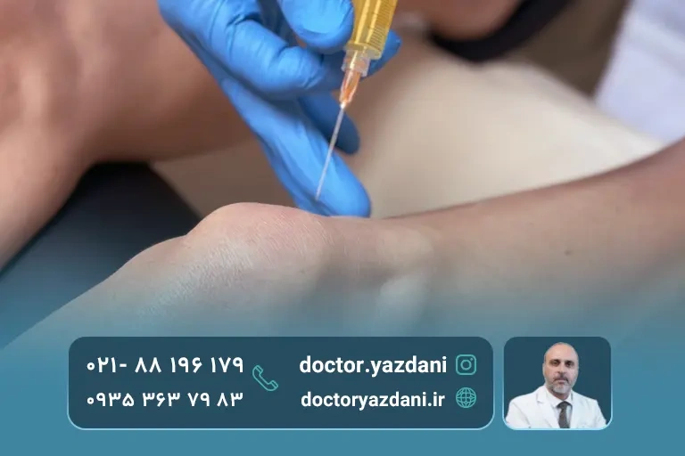 تزریق پی آرپی به زانو به کمک دکتر