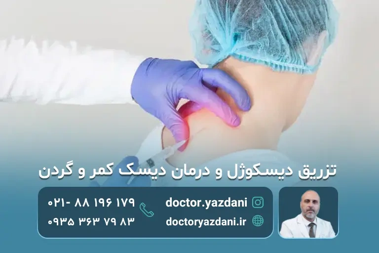 تزریق دیسکوژل به بیمار