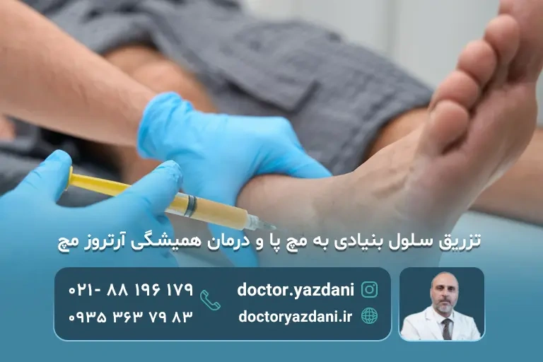 تزریق سلول بنیادی به مچ پا