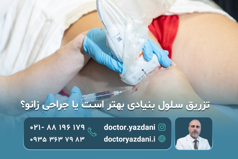 مقایسه تزریق سلول بنیادی و جراحی زانو 