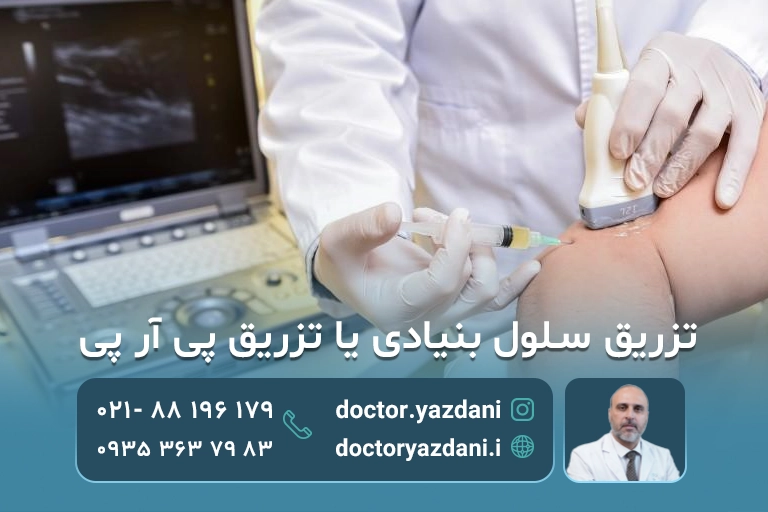مقایسه تزریق سلول بنیادی و PRP
