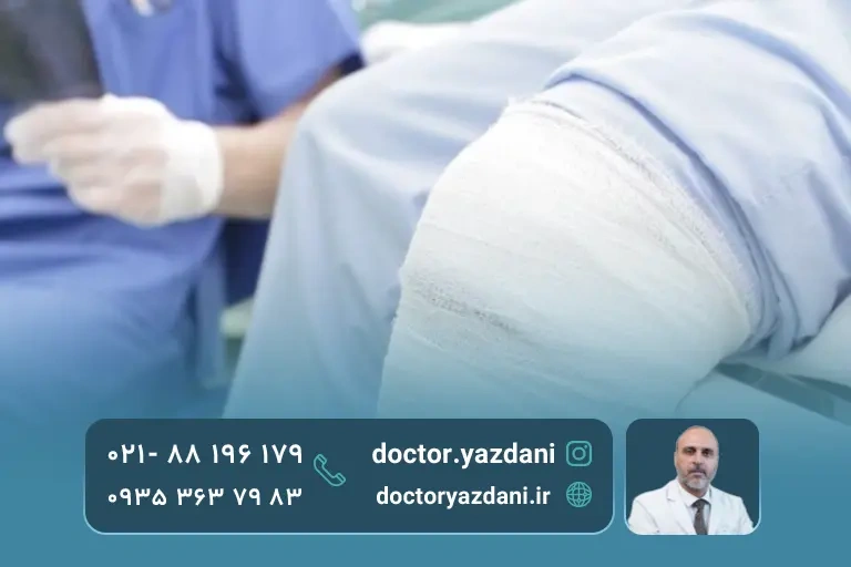 عکسبرداری ام آر آی از مینیسک زانو