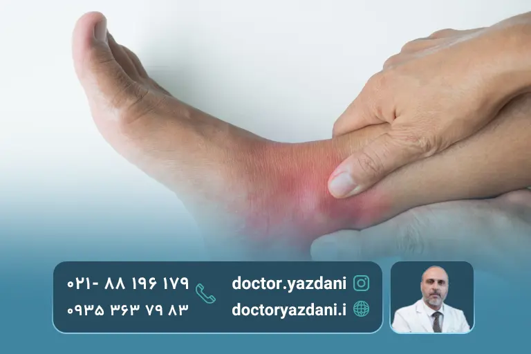 تورم و خشکی مفصل
