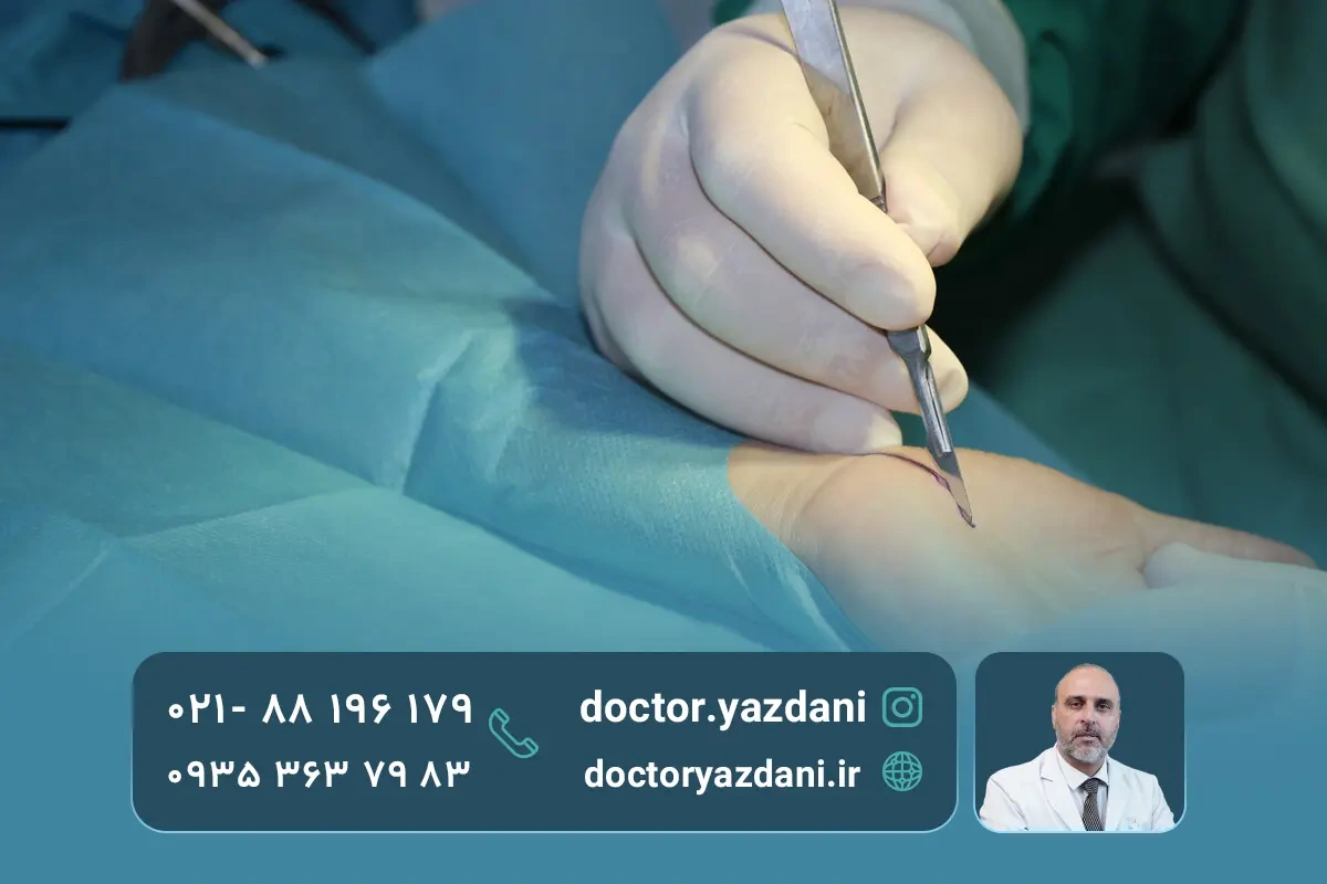 جدیدترین روش های درمان جراحی و غیرجراحی دست