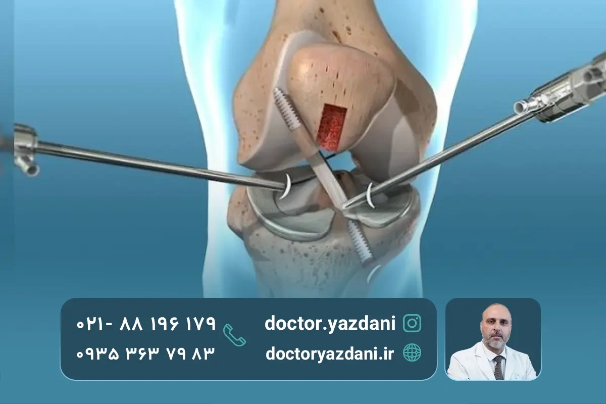 جراحی آرتروسکوپی چیست؟