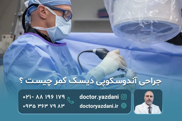 عمل آندوسکوپی دیسک کمر چگونه انجام می شود؟ مزایا،معایب،عوارض،دوره نقاهت