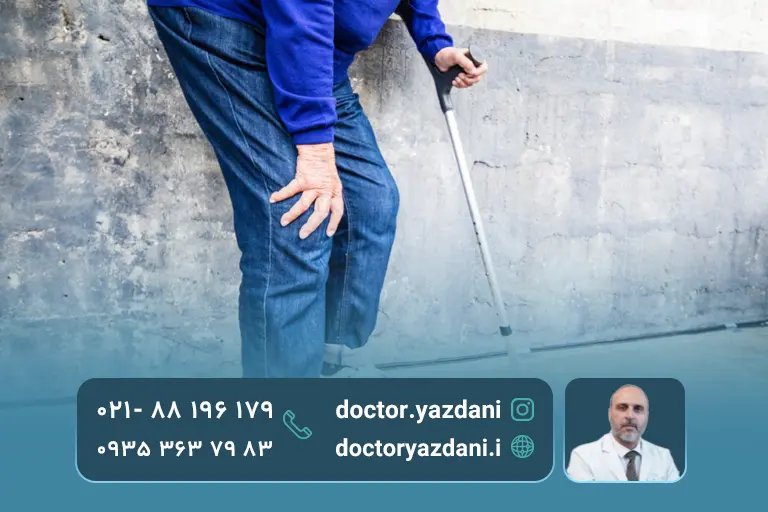 خطرات پیشرفته آرتروز