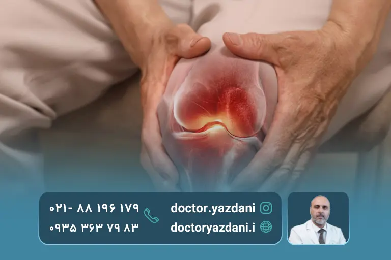 دد مداوم و شدید مفصل