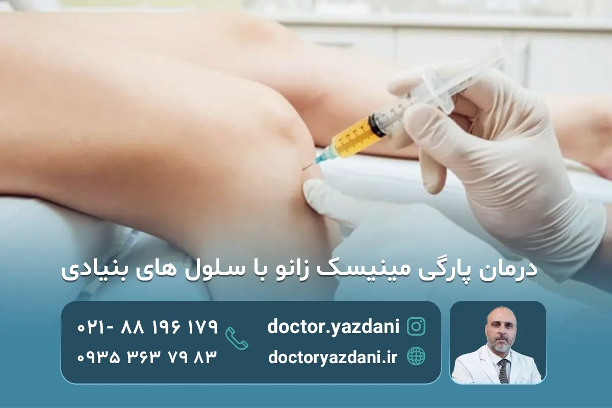 درمان مینیسک زانو با سلول‌ های بنیادی بدون جراحی