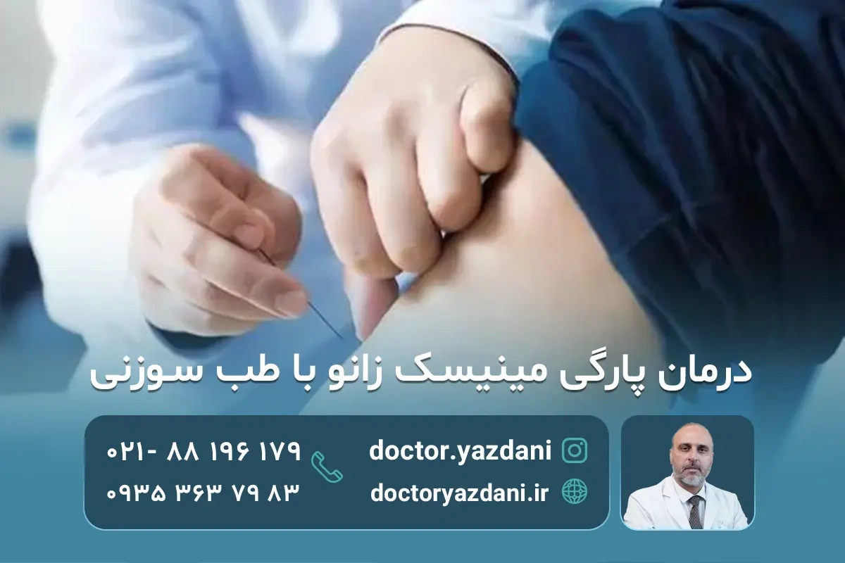 درمان پارگی مینیسک زانو در طب سوزنی+عوارض و هزینه