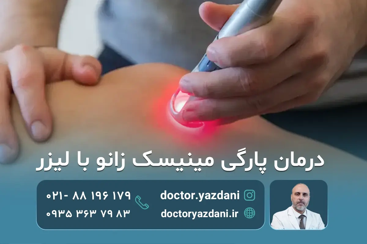 درمان پارگی مینیسک زانو با لیزر | مزایا، مراحل درمان