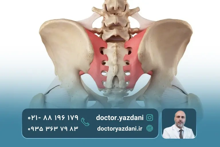 درمان التهاب مفال ساکروالیاک
