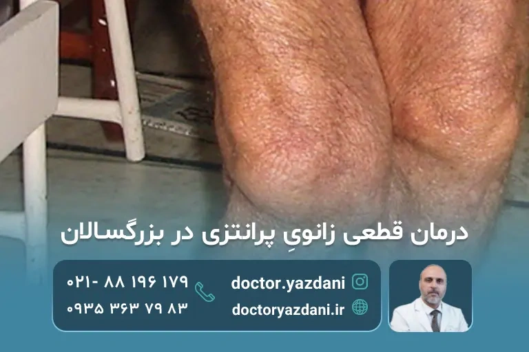 زانوی پرانتزی شخص بزرگسال