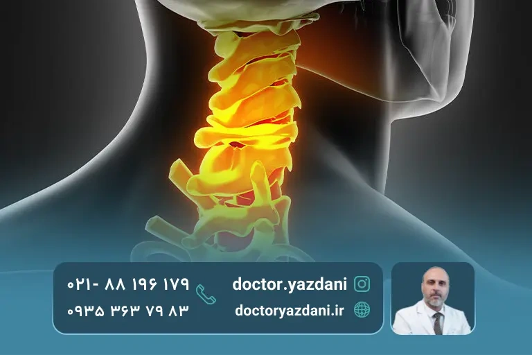 درمان گرفتگی و درد پشت گردن