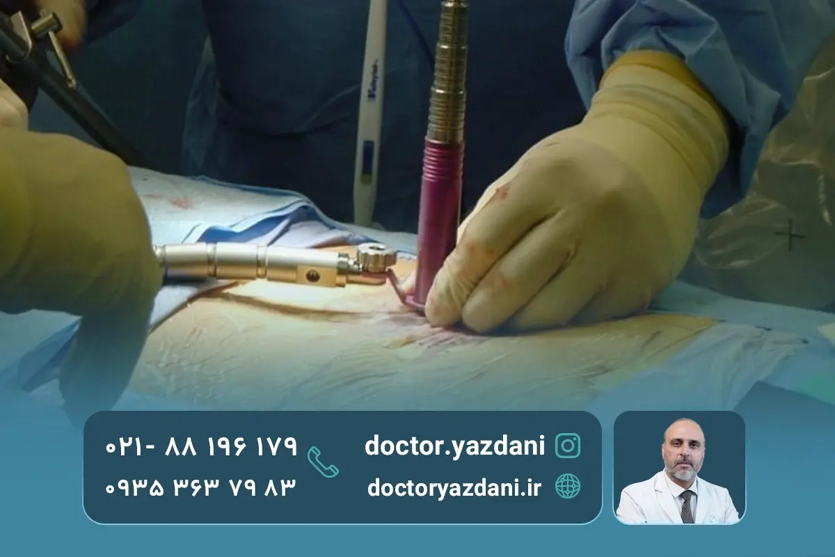  درمان‌های جراحی دیسک کمر و بی‌ حسی پا