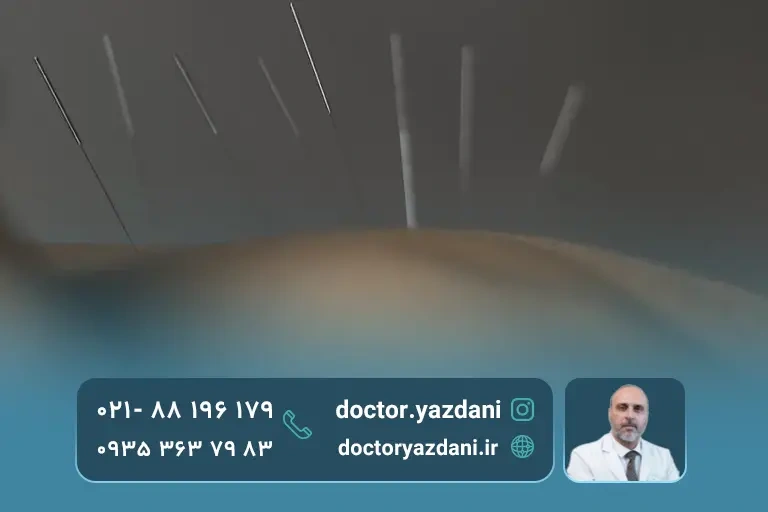 درمان های فیبرومیالژیا