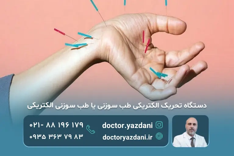 دستگاه تحریک الکتریکی طب سوزنی یا طب سوزنی الکتریکی (چیست)
