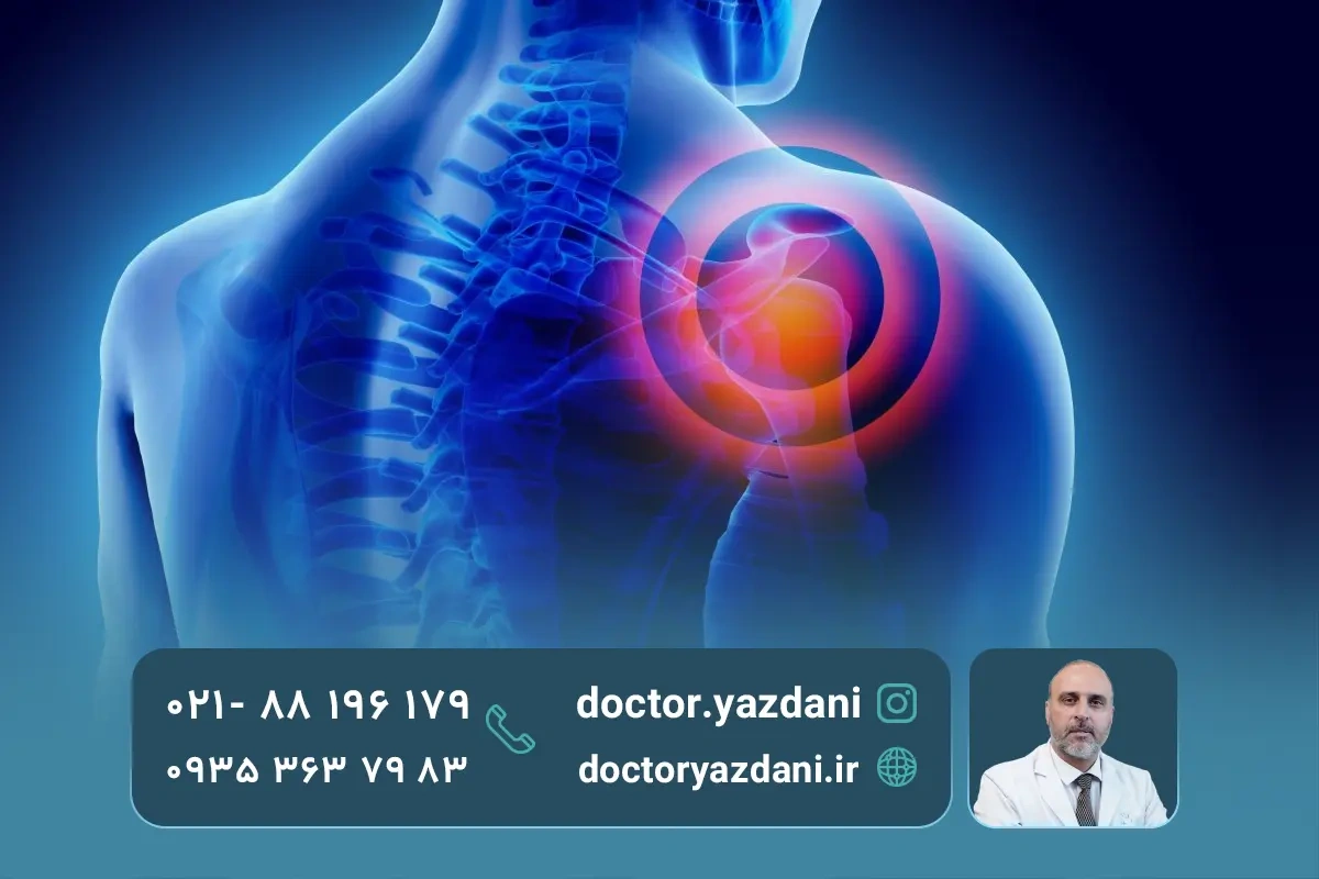 دلایل درد شانه