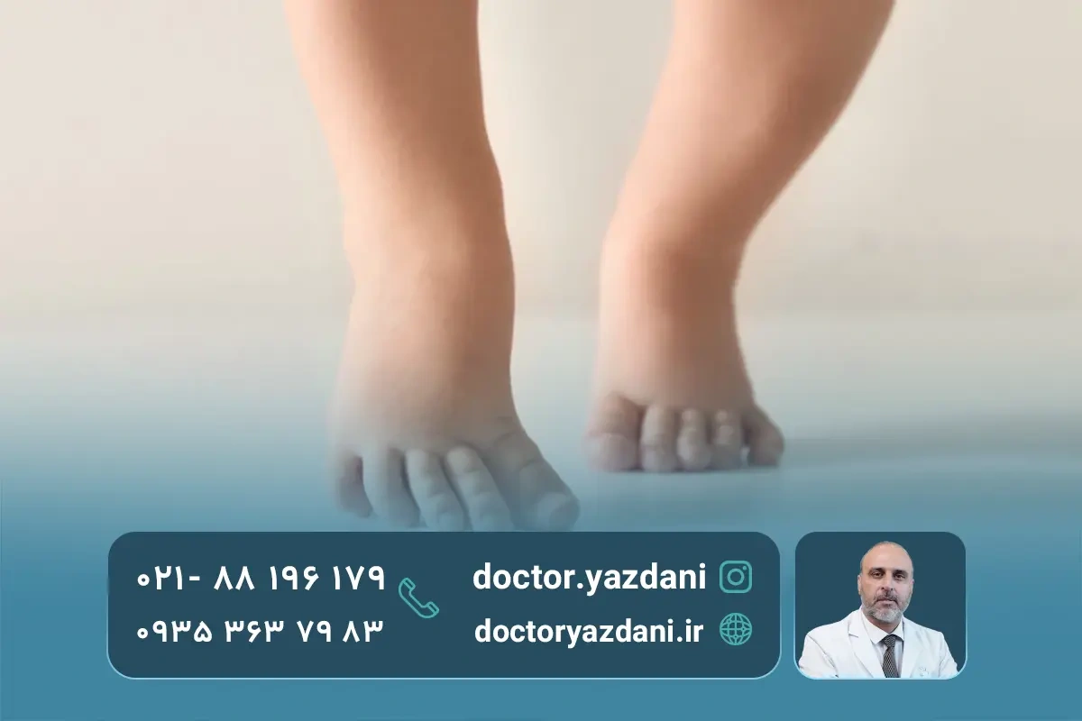 دلایل صافی کف پا در کودکان