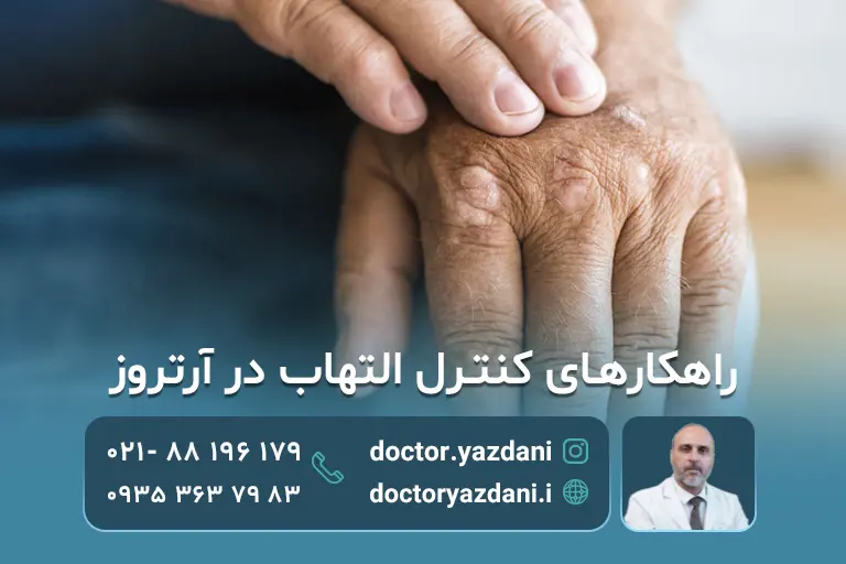 راهکار های کنترل التهاب در آرتروز
