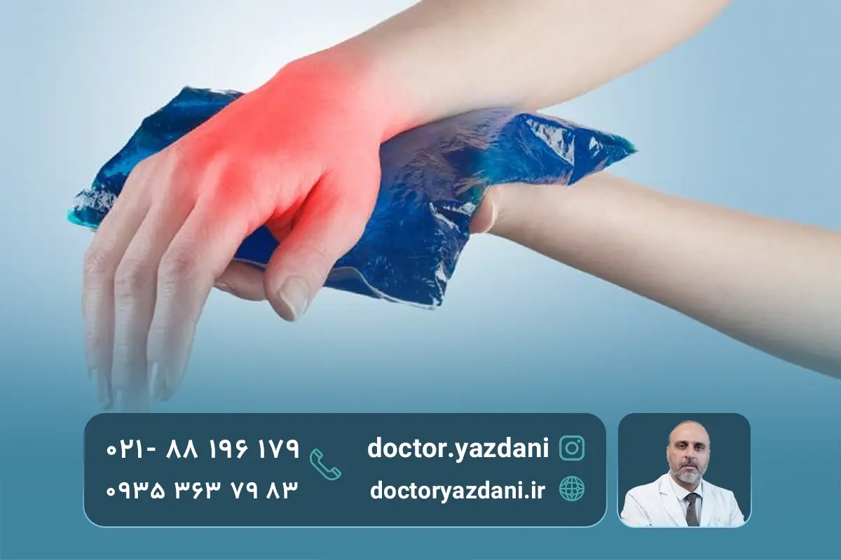 راه‌ های درمان داغی کف دست