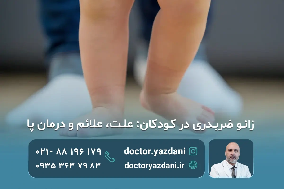 زانویِ ضربدری در کودکان؛ از علائم تا بهترین راه‌های درمان