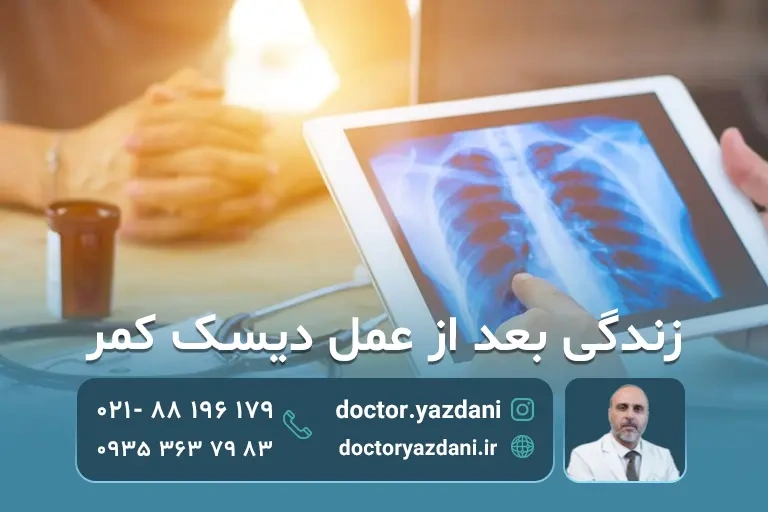 زندگی بعد از عمل دیسک کمر و نکات مهم ریکاوری و تقویت کمر