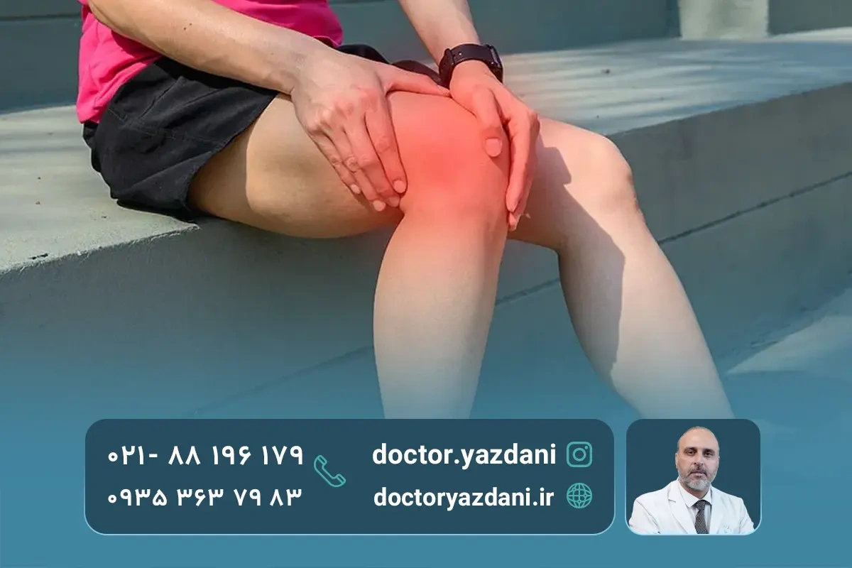 شایع‌ترین دلایل درد بغل زانو چیست؟
