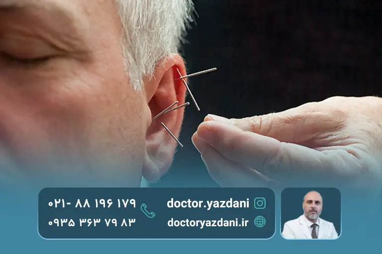 طب سوزنی چه درد هایی از گوش را درمان می کند