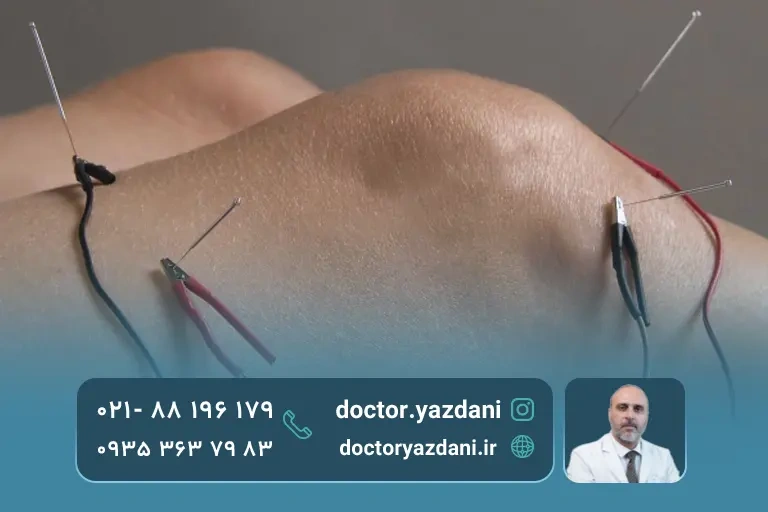 طب سوزنی الکتریکی