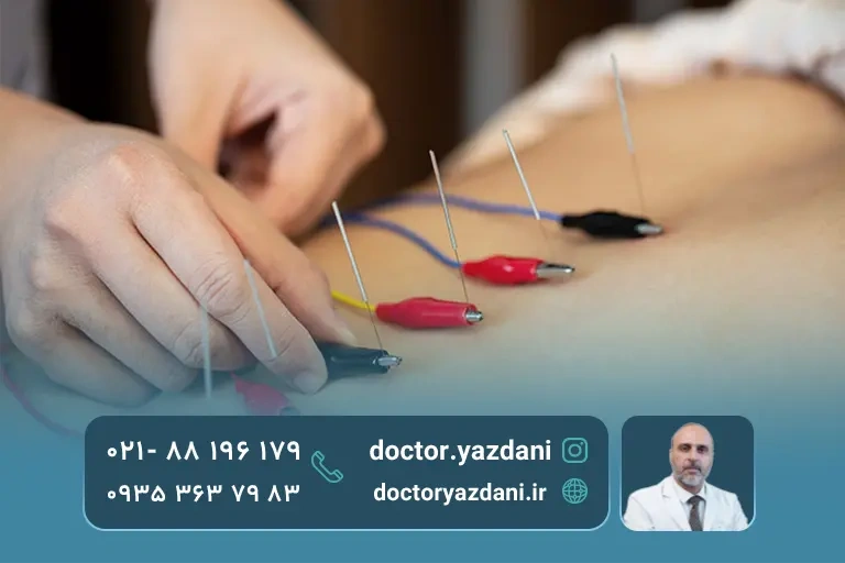 طب سوزنی الکتریکی روی کمر