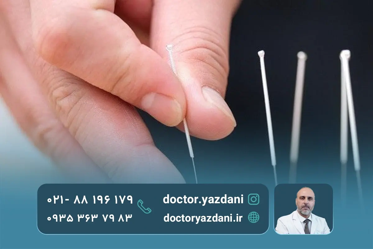 طب سوزنی چیست و چگونه عمل می کند